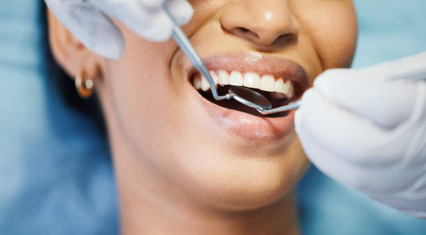 Best After-Hours Dental Trauma Care in Hickory Hls, IL